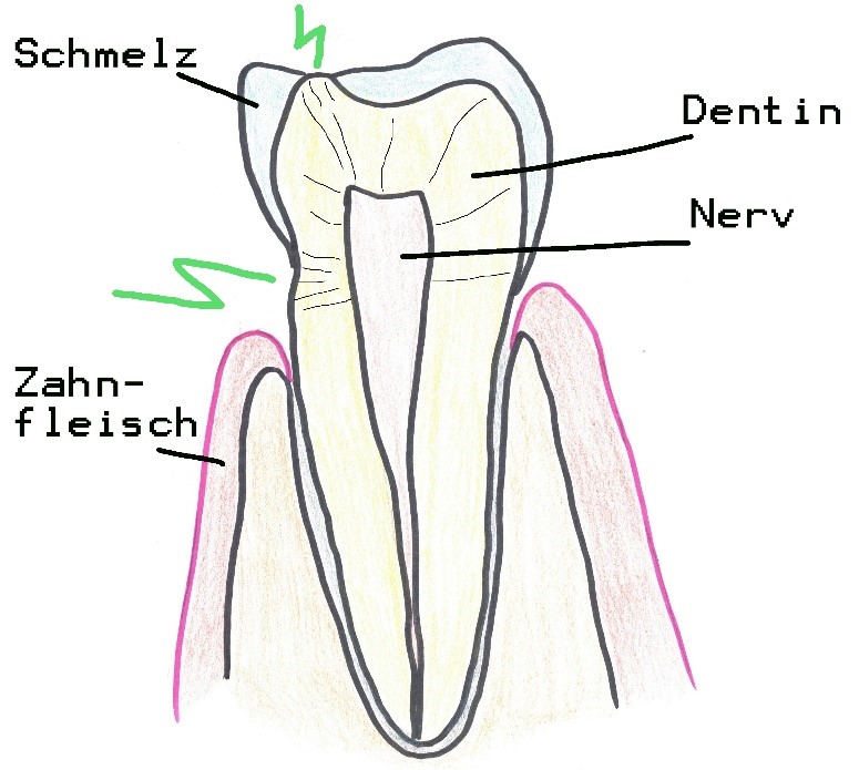 Bild Zahn